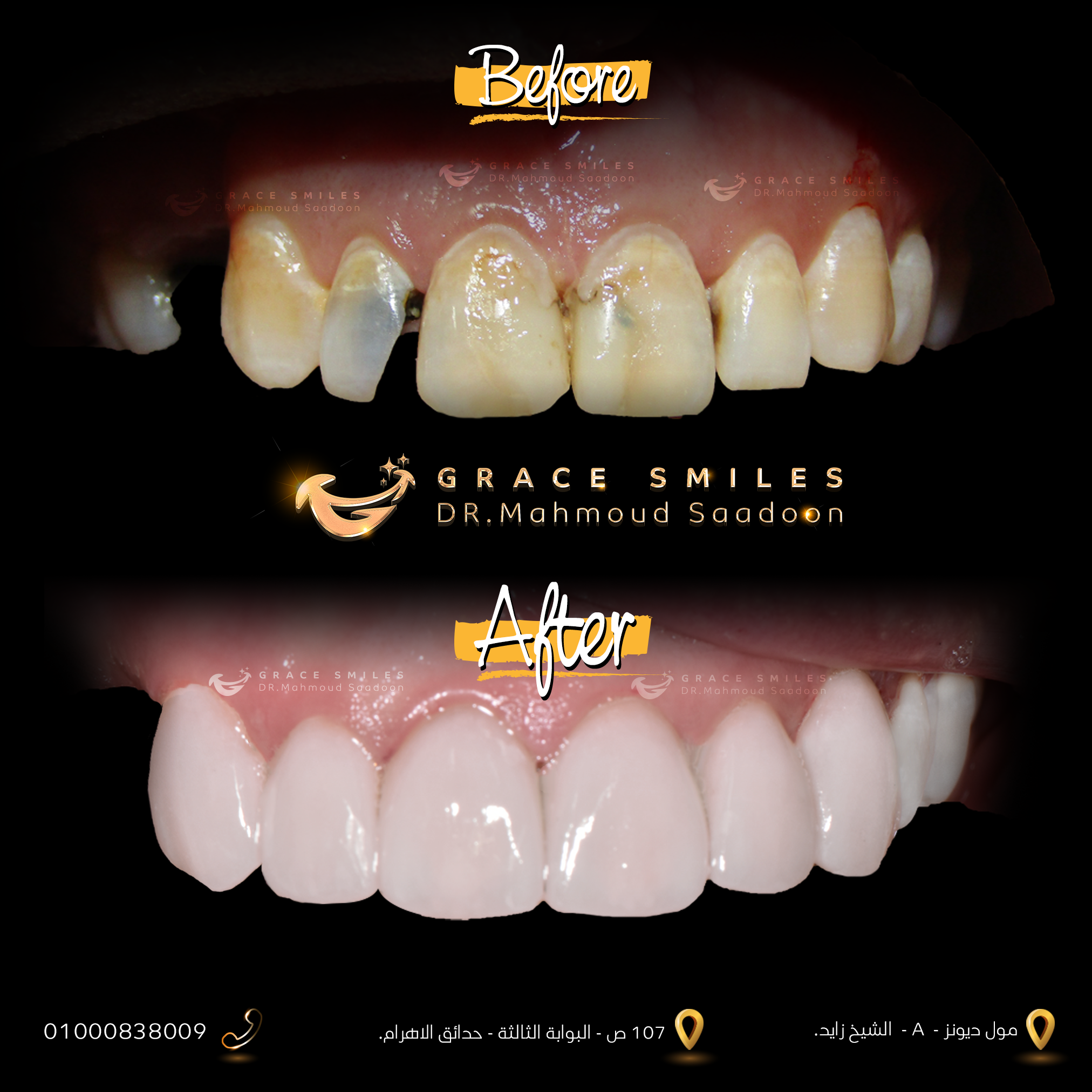 patients teeth before and after