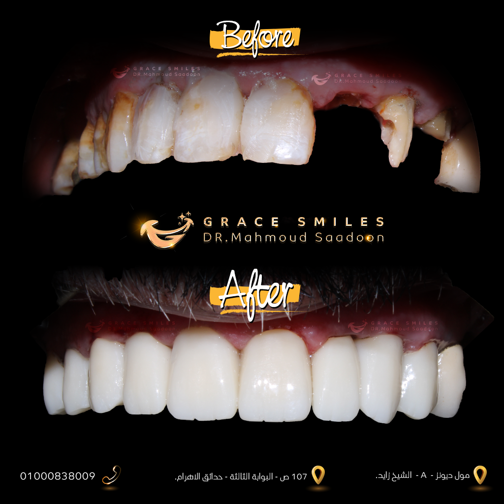 patients teeth before and after