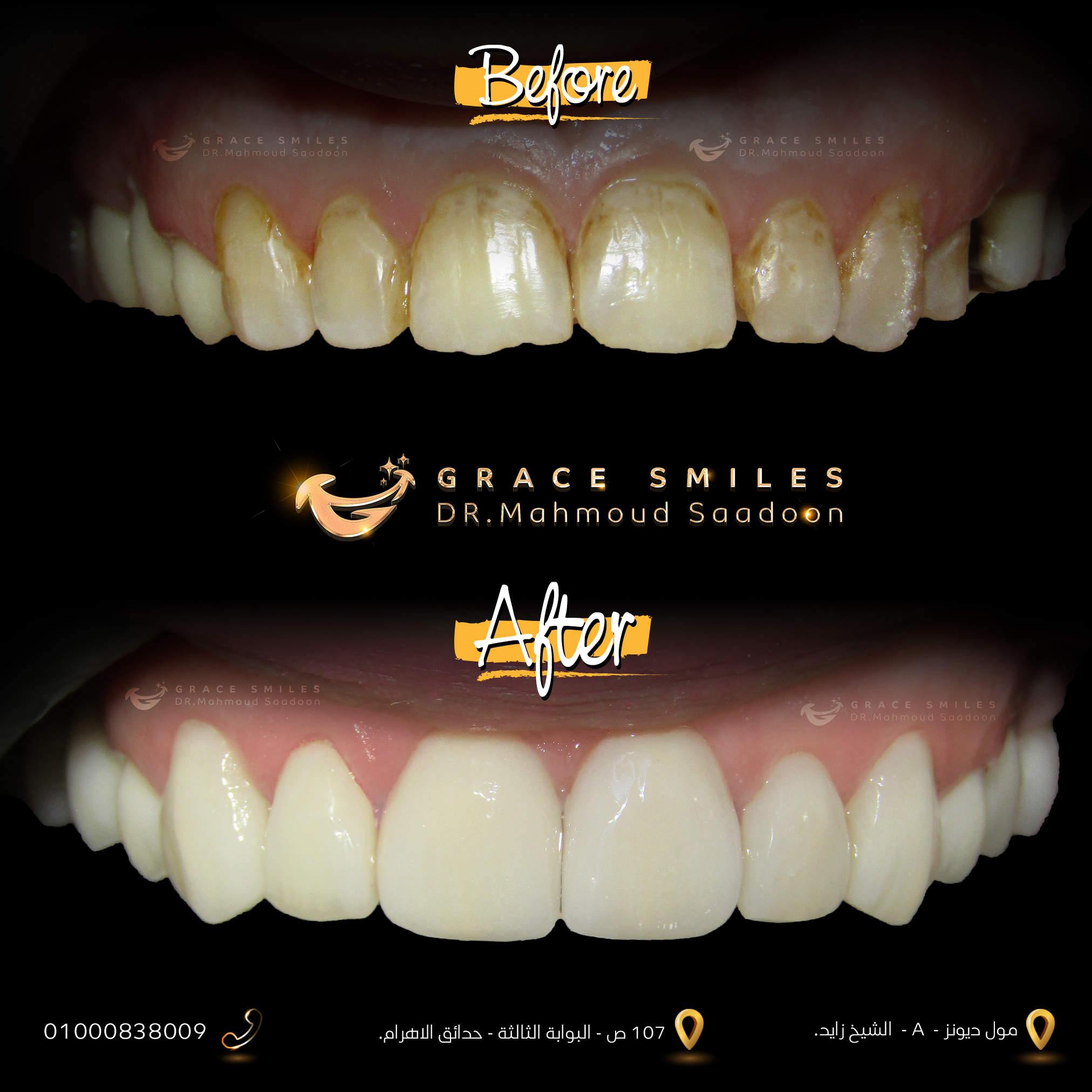 patients teeth before and after