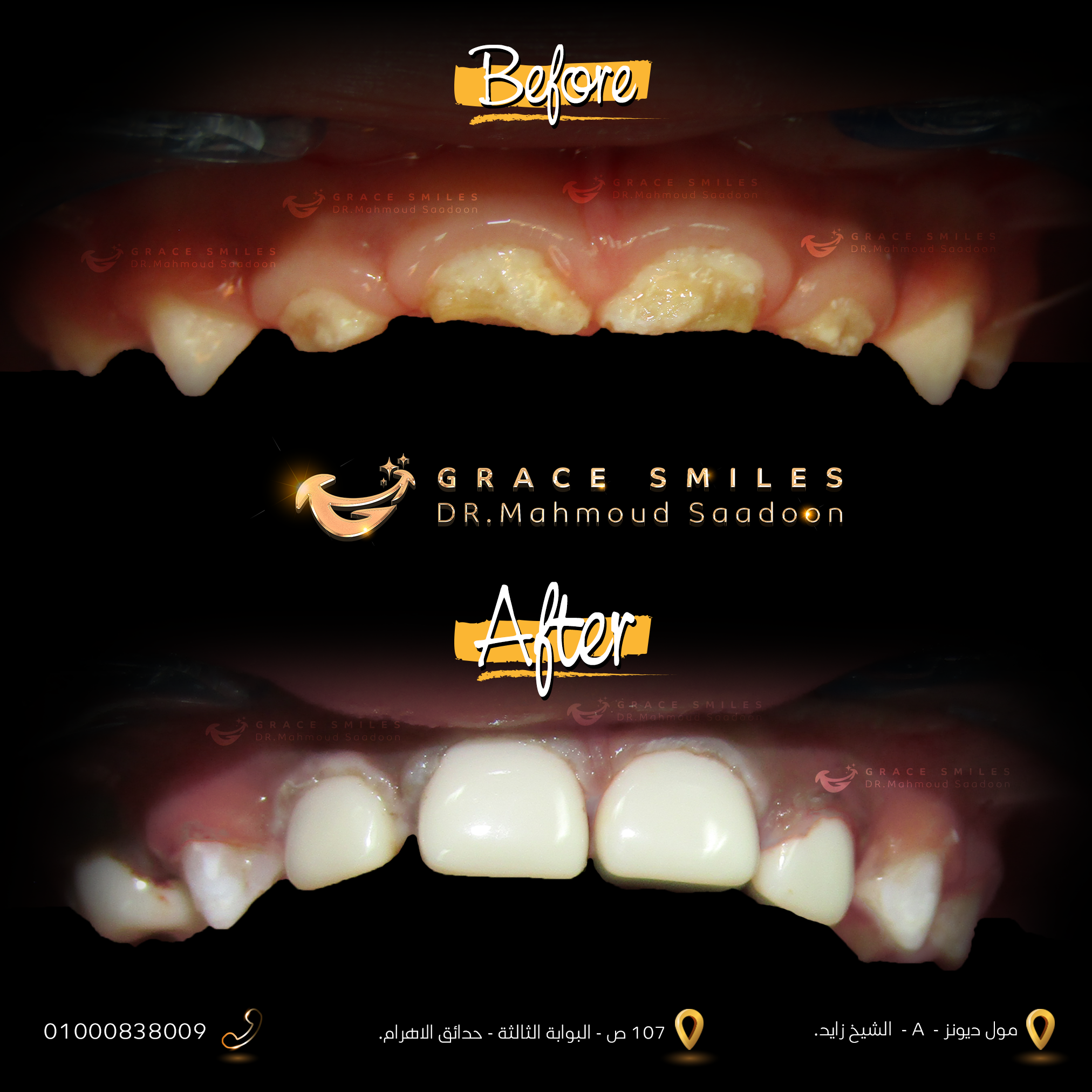 patients teeth before and after