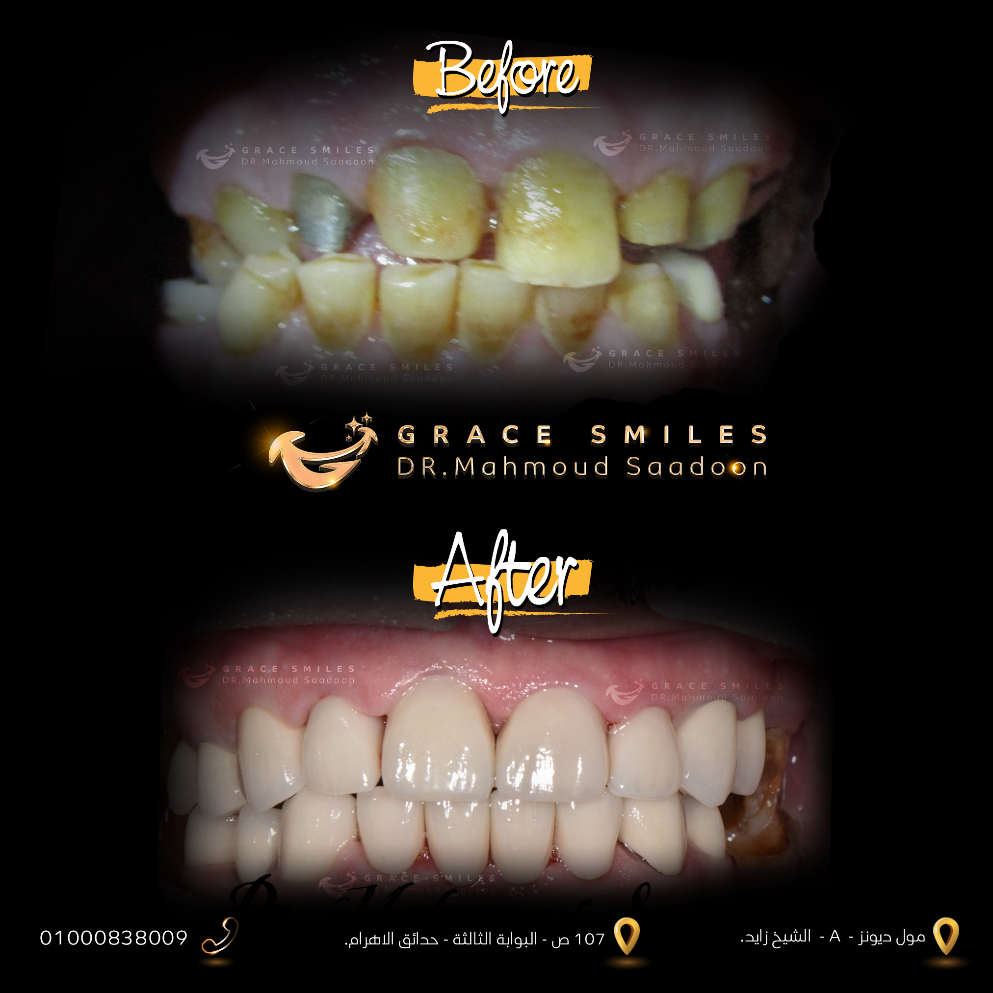 patients teeth before and after