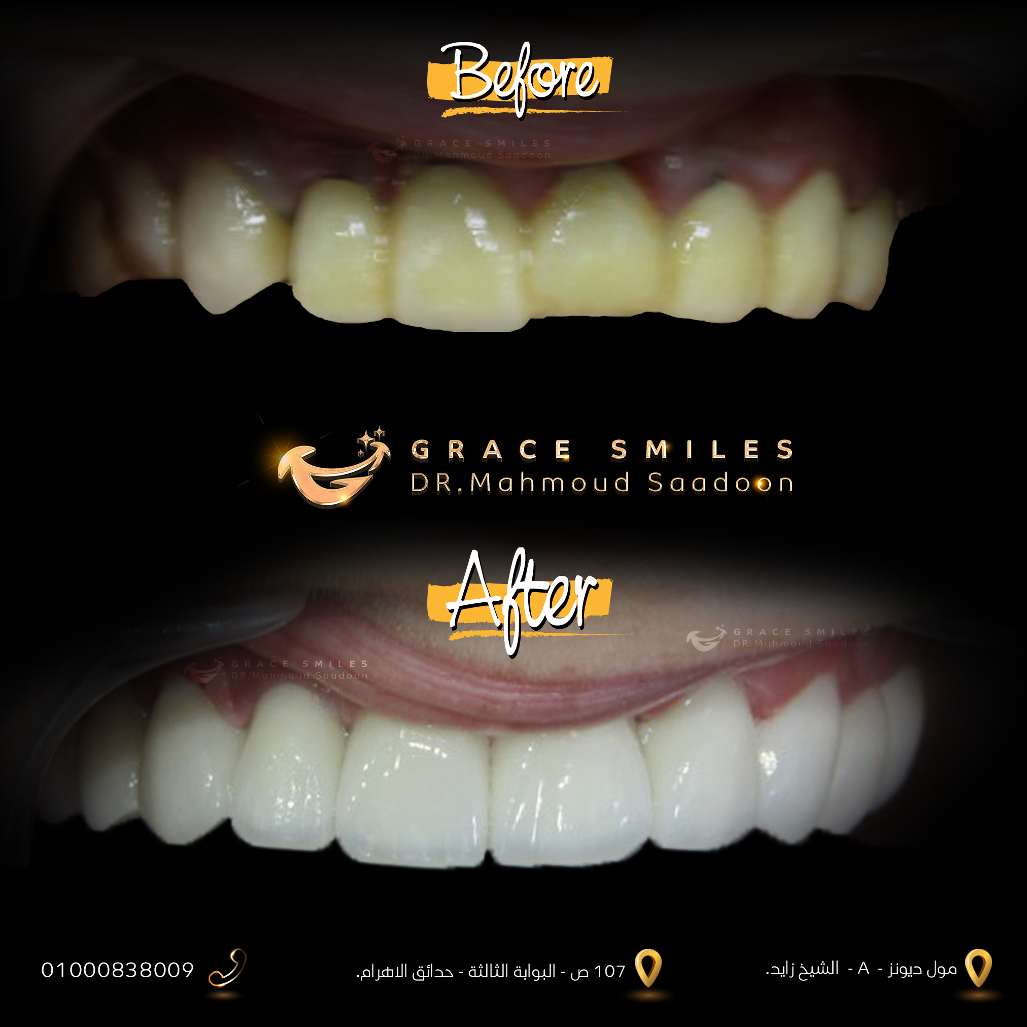 patients teeth before and after