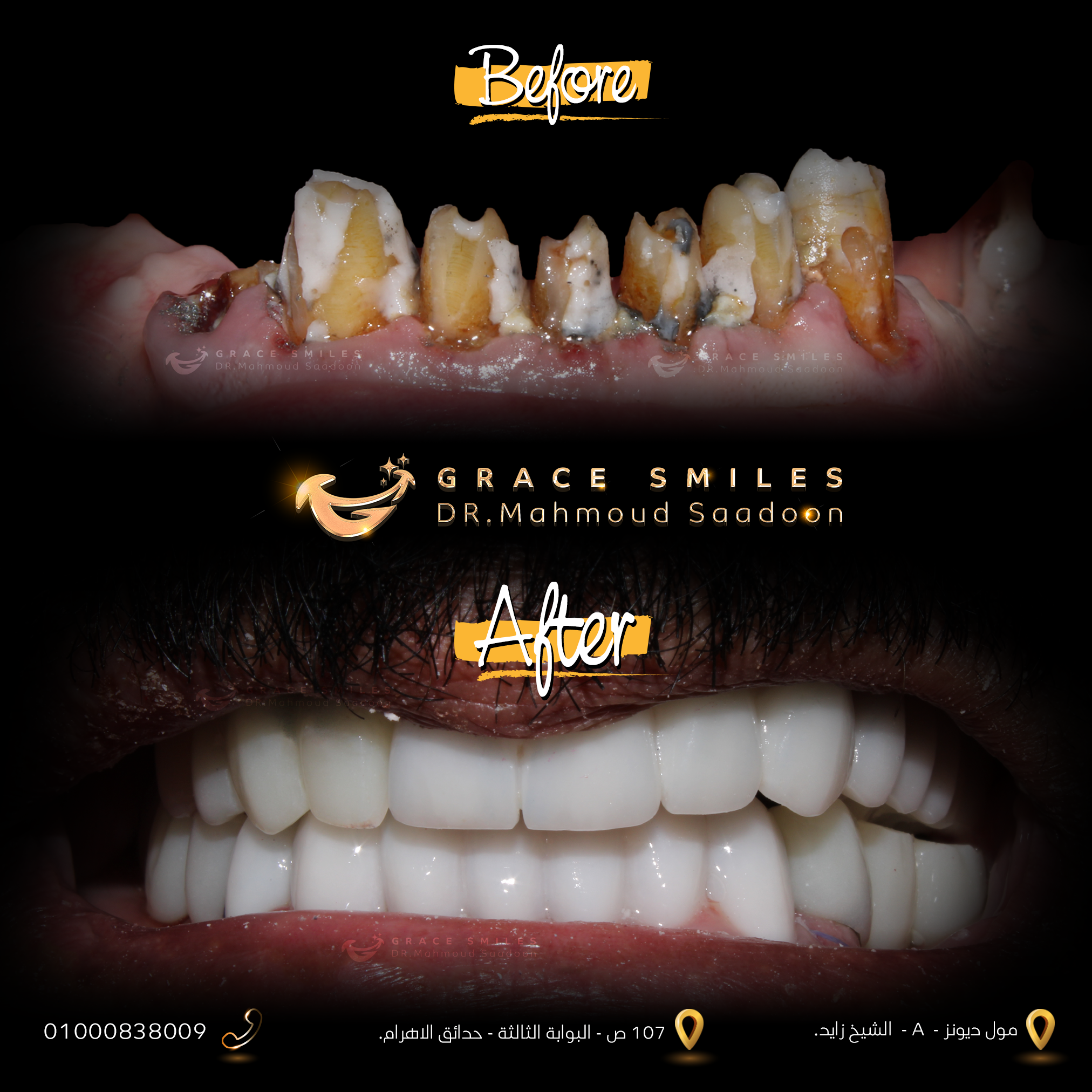 patients teeth before and after