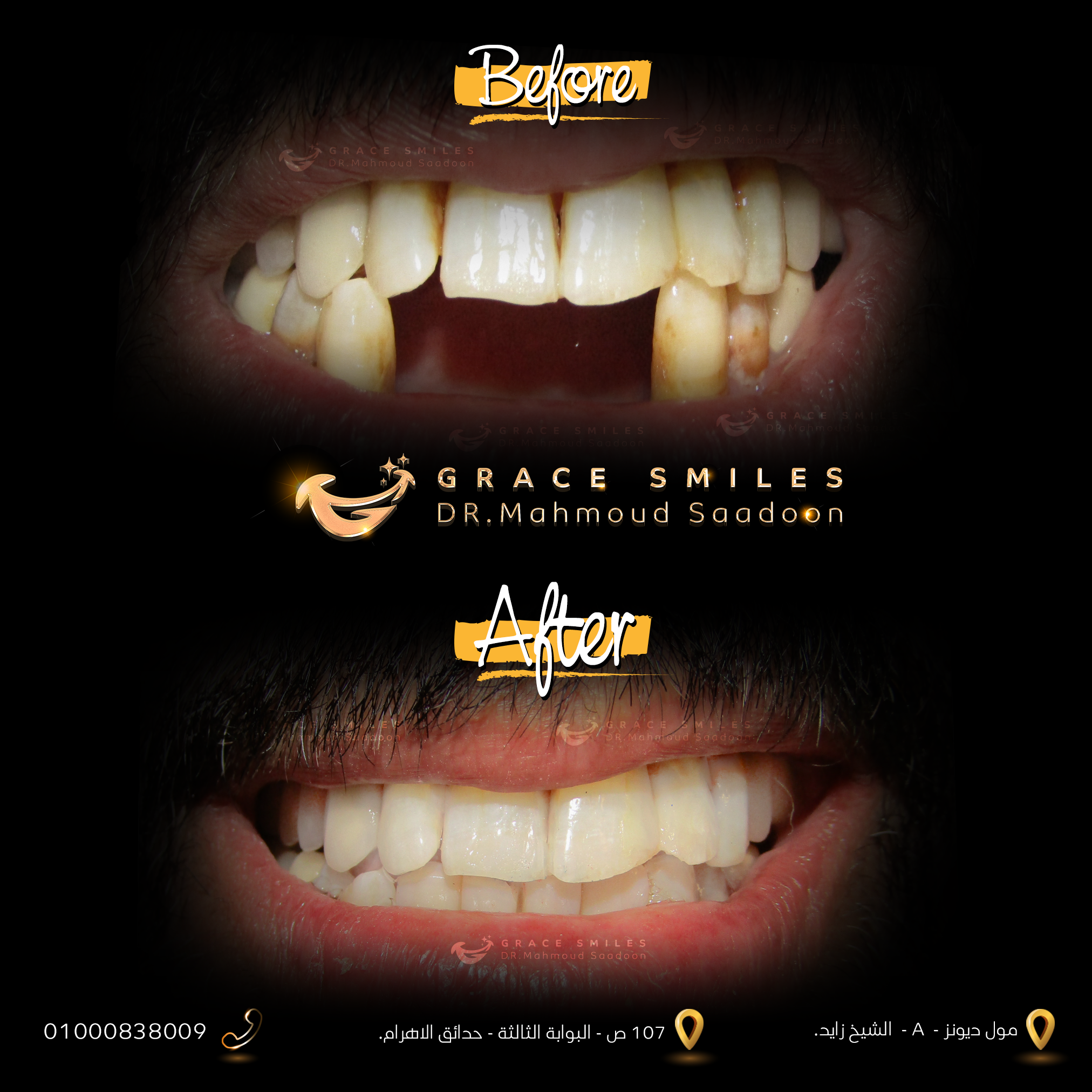 patients teeth before and after