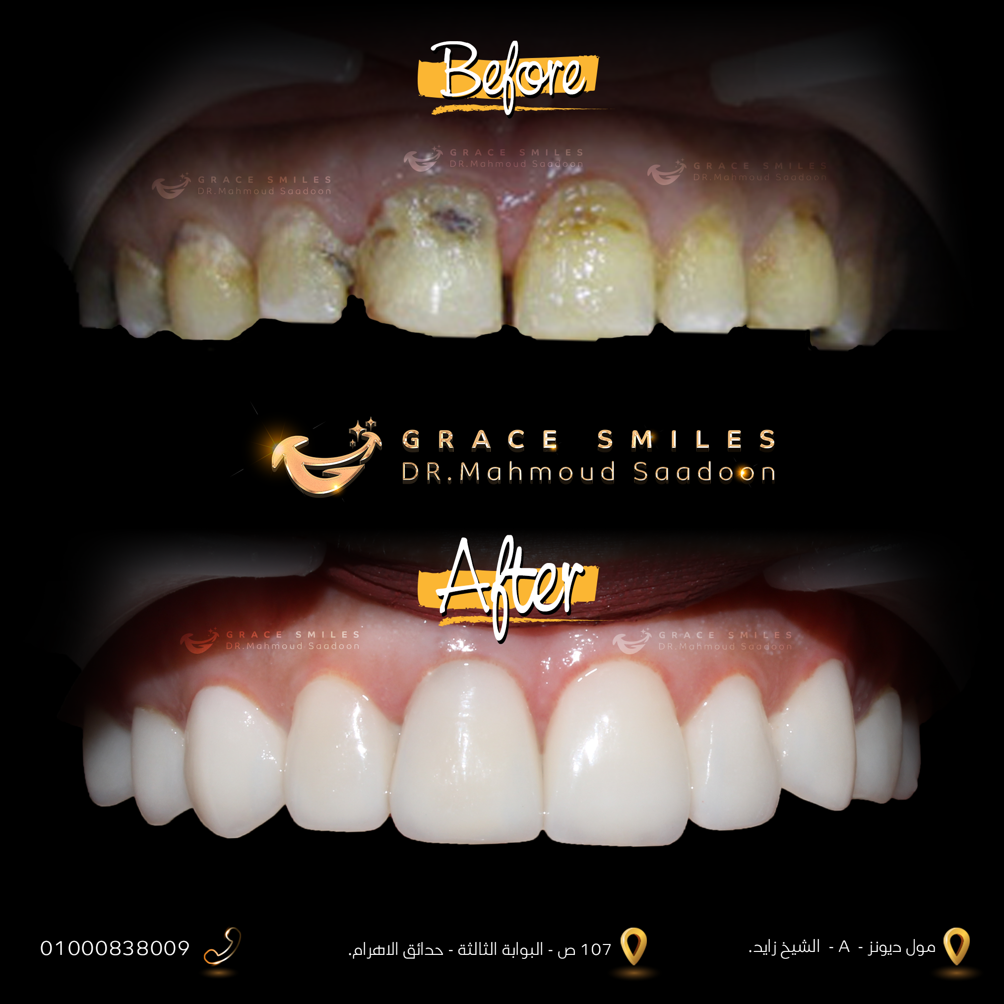 patients teeth before and after